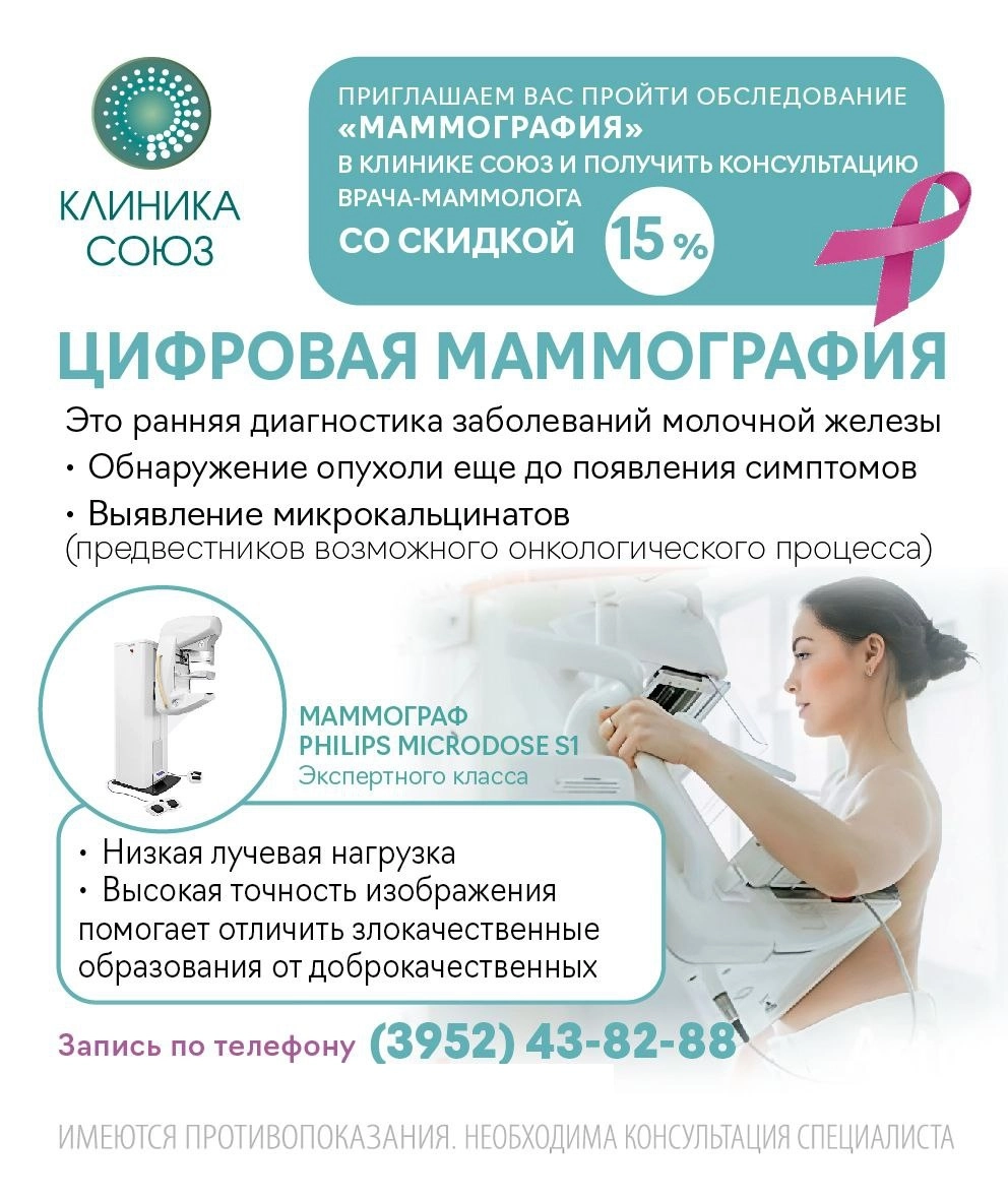 Акция ММК Союз 